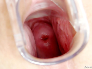 от близо, гинеколог, обувки на токчета